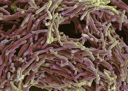Image: Colored scanning electron micrograph (SEM) of Mycobacterium tuberculosis bacteria, the main cause of human tuberculosis (Photo courtesy of A. Dowsett, Health Protection Agency / SPL). Image: Colored scanning electron micrograph (SEM) of Mycobacterium tuberculosis bacteria, the main cause of human tuberculosis (Photo courtesy of A. Dowsett, Health Protection Agency / SPL).